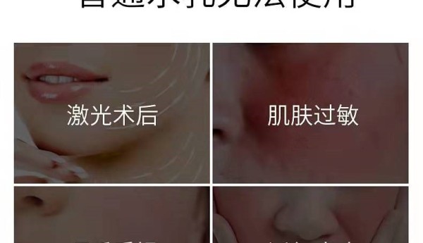 逃不掉的肌肤过敏？交给活玉玉石养肤水乳来修复肌肤屏障