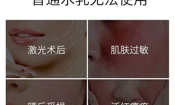 逃不掉的肌肤过敏？交给活玉玉石养肤水乳来修复肌肤屏障